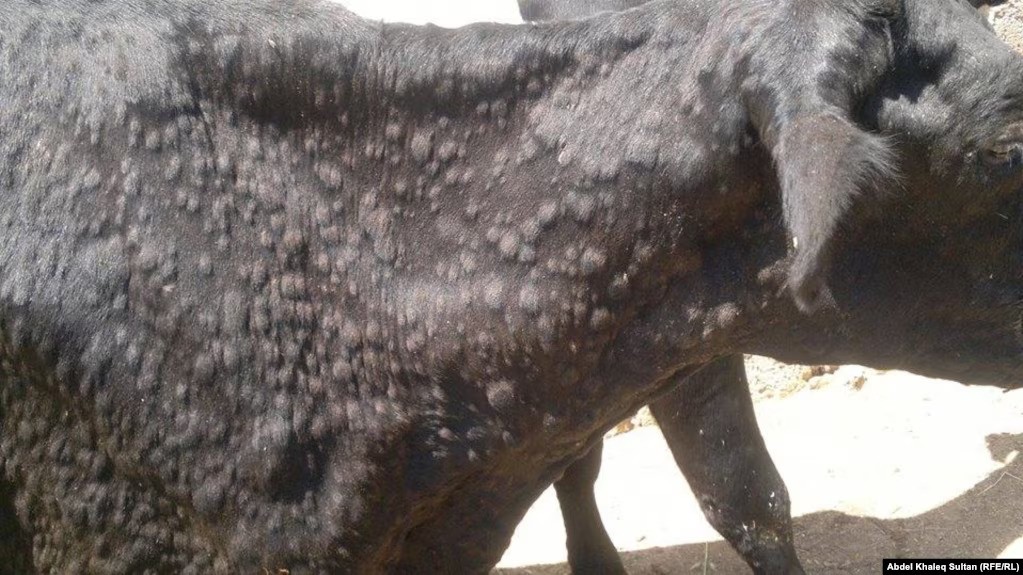 Səhiyyə Nazirliyi qarayara ilə bağlı: Avqustun 15-dən yeni yoluxma qeydə alınmayıb